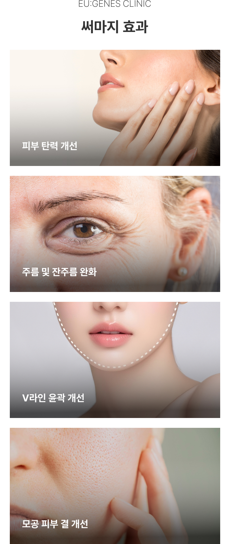 써마지리프팅 압구정 유진스의원, 써마지 효과 - 피부 탄력 개선, 주름 및 잔주름 완화, V라인 윤곽 개선, 모공과 피부 결 개선