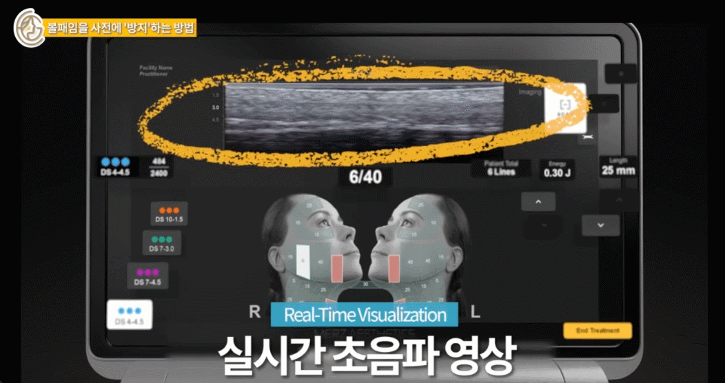 신사 울쎄라 추천, 어떤 기준을 살펴보면 좋을까요?